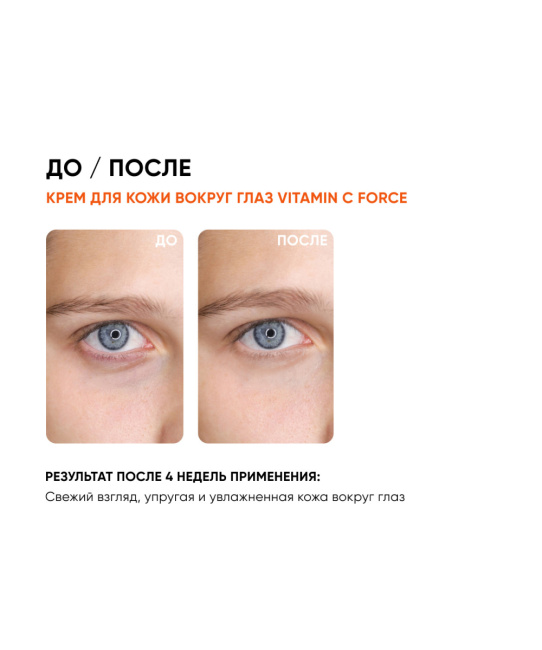 Icon skin Крем для кожи вокруг глаз с витамином С, 175мл (4)
