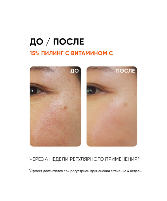 Icon skin Пилинг с витамином С 15%, 30мл (2)