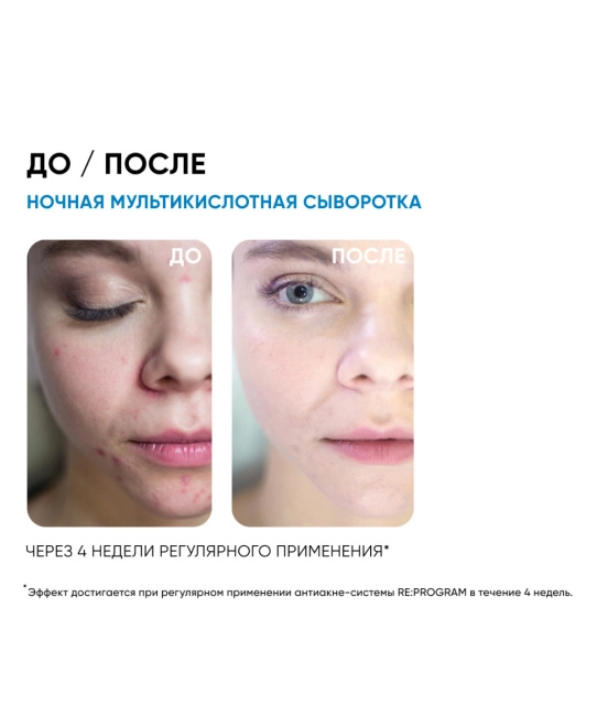 Icon skin Сыворотка для лица мультикислотная ночная, 30мл (3)