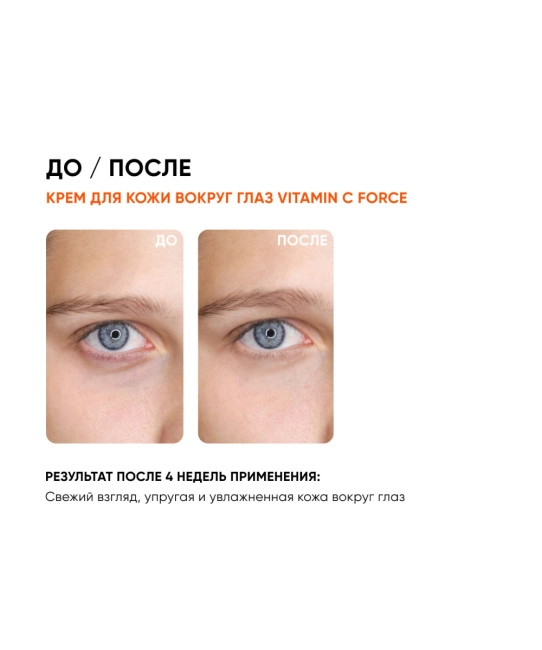 Icon skin Крем для кожи вокруг глаз с витамином С, 175мл (4)